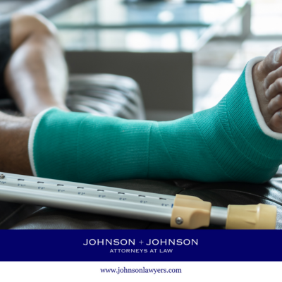 Following an accident caused by negligence in Cayce, SC, an injury victim props up their broken leg with a cast 