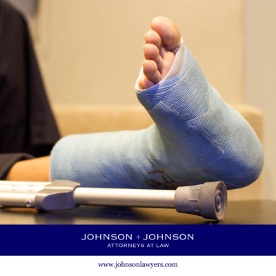 A personal injury victim in Seven Oaks, SC with an injured leg in a blue cast