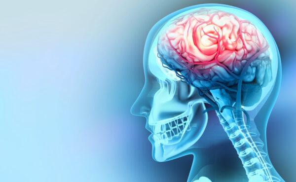 An image of the inside of the head through the skull where the brain in visible.